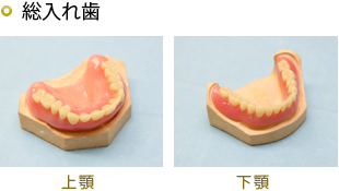 レジン床義歯　保険適応